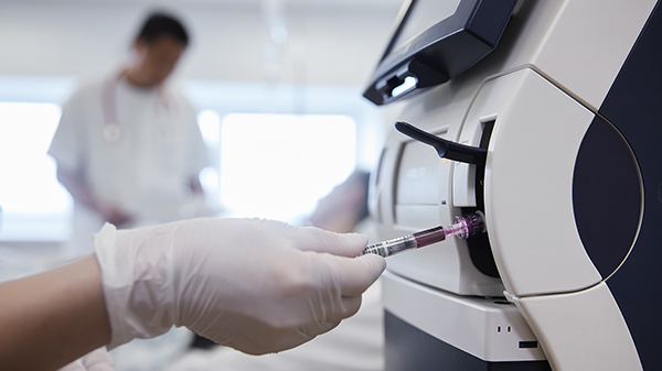 Analyse mit dem ABL90 Analysator von Radiometer